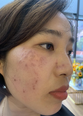 CHỊ HOA