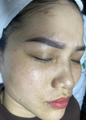 CHỊ LAN